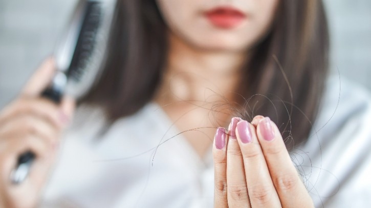 Korean researchers have found a potential new therapeutic compound for hair loss. ©Getty Images